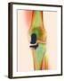 Knee Joint Prosthesis, X-ray-Science Photo Library-Framed Photographic Print