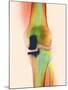 Knee Joint Prosthesis, X-ray-Science Photo Library-Mounted Photographic Print