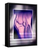 Knee Joint, Side View, MRI Scan-Miriam Maslo-Framed Stretched Canvas