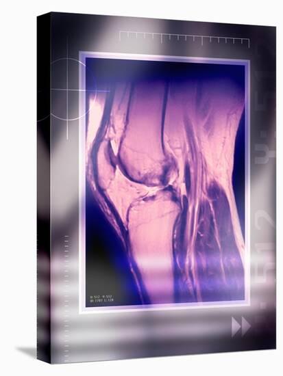 Knee Joint, Side View, MRI Scan-Miriam Maslo-Stretched Canvas