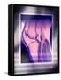 Knee Joint, Side View, MRI Scan-Miriam Maslo-Framed Stretched Canvas