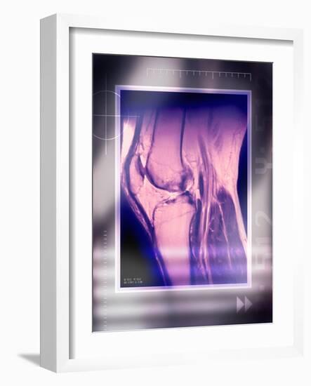 Knee Joint, Side View, MRI Scan-Miriam Maslo-Framed Photographic Print