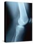 Knee Joint X-Ray-Robert Llewellyn-Stretched Canvas