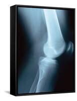 Knee Joint X-Ray-Robert Llewellyn-Framed Stretched Canvas