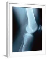 Knee Joint X-Ray-Robert Llewellyn-Framed Photographic Print