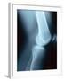 Knee Joint X-Ray-Robert Llewellyn-Framed Photographic Print