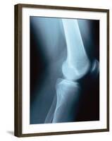 Knee Joint X-Ray-Robert Llewellyn-Framed Photographic Print