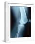 Knee Joint X-Ray-Robert Llewellyn-Framed Photographic Print