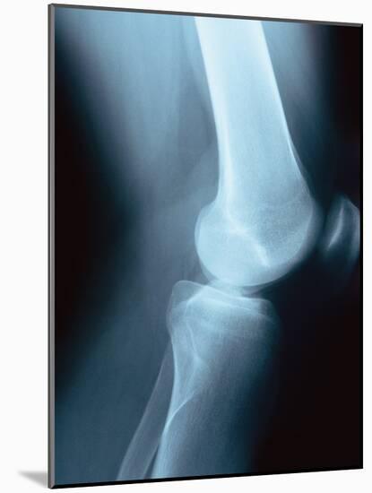 Knee Joint X-Ray-Robert Llewellyn-Mounted Photographic Print