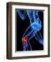 Knee Pain, Conceptual Artwork-SCIEPRO-Framed Premium Photographic Print