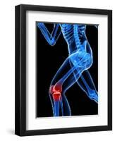 Knee Pain, Conceptual Artwork-SCIEPRO-Framed Premium Photographic Print