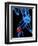 Knee Pain, Conceptual Artwork-SCIEPRO-Framed Premium Photographic Print