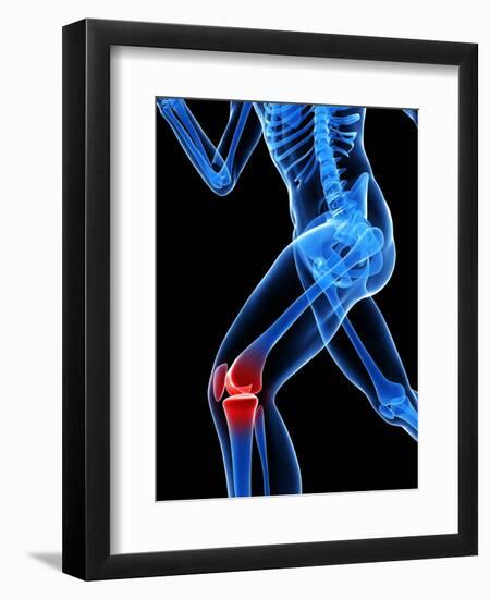 Knee Pain, Conceptual Artwork-SCIEPRO-Framed Premium Photographic Print