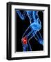 Knee Pain, Conceptual Artwork-SCIEPRO-Framed Premium Photographic Print