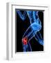 Knee Pain, Conceptual Artwork-SCIEPRO-Framed Premium Photographic Print