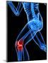 Knee Pain, Conceptual Artwork-SCIEPRO-Mounted Premium Photographic Print