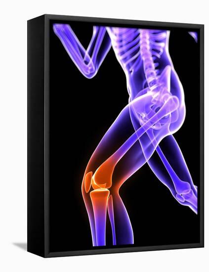 Knee Pain, Conceptual Artwork-SCIEPRO-Framed Stretched Canvas