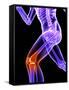 Knee Pain, Conceptual Artwork-SCIEPRO-Framed Stretched Canvas