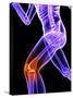 Knee Pain, Conceptual Artwork-SCIEPRO-Stretched Canvas