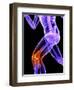 Knee Pain, Conceptual Artwork-SCIEPRO-Framed Premium Photographic Print