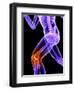 Knee Pain, Conceptual Artwork-SCIEPRO-Framed Premium Photographic Print