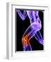 Knee Pain, Conceptual Artwork-SCIEPRO-Framed Premium Photographic Print