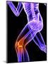 Knee Pain, Conceptual Artwork-SCIEPRO-Mounted Premium Photographic Print