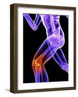 Knee Pain, Conceptual Artwork-SCIEPRO-Framed Photographic Print