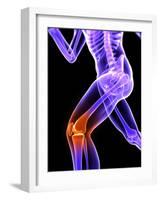 Knee Pain, Conceptual Artwork-SCIEPRO-Framed Photographic Print