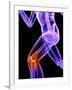 Knee Pain, Conceptual Artwork-SCIEPRO-Framed Photographic Print