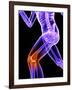 Knee Pain, Conceptual Artwork-SCIEPRO-Framed Photographic Print