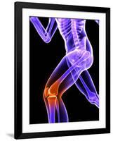 Knee Pain, Conceptual Artwork-SCIEPRO-Framed Photographic Print