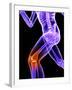 Knee Pain, Conceptual Artwork-SCIEPRO-Framed Photographic Print