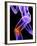 Knee Pain, Conceptual Artwork-SCIEPRO-Framed Photographic Print