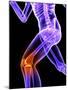 Knee Pain, Conceptual Artwork-SCIEPRO-Mounted Photographic Print