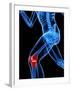 Knee Pain, Conceptual Artwork-SCIEPRO-Framed Photographic Print