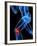 Knee Pain, Conceptual Artwork-SCIEPRO-Framed Photographic Print