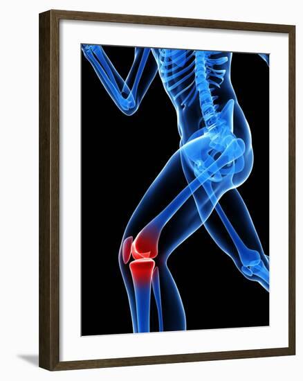 Knee Pain, Conceptual Artwork-SCIEPRO-Framed Photographic Print