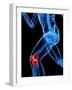 Knee Pain, Conceptual Artwork-SCIEPRO-Framed Photographic Print