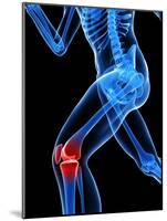 Knee Pain, Conceptual Artwork-SCIEPRO-Mounted Photographic Print