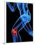 Knee Pain, Conceptual Artwork-SCIEPRO-Framed Photographic Print