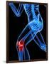 Knee Pain, Conceptual Artwork-SCIEPRO-Framed Photographic Print