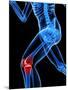 Knee Pain, Conceptual Artwork-SCIEPRO-Mounted Photographic Print