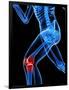 Knee Pain, Conceptual Artwork-SCIEPRO-Framed Photographic Print