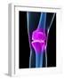 Knee Pain, Conceptual Artwork-SCIEPRO-Framed Photographic Print