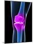 Knee Pain, Conceptual Artwork-SCIEPRO-Mounted Photographic Print