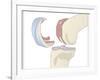 Knee Replacement, Artwork-Peter Gardiner-Framed Photographic Print