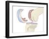 Knee Replacement, Artwork-Peter Gardiner-Framed Photographic Print