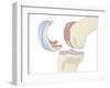 Knee Replacement, Artwork-Peter Gardiner-Framed Photographic Print