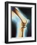 Knee X-ray-null-Framed Photographic Print